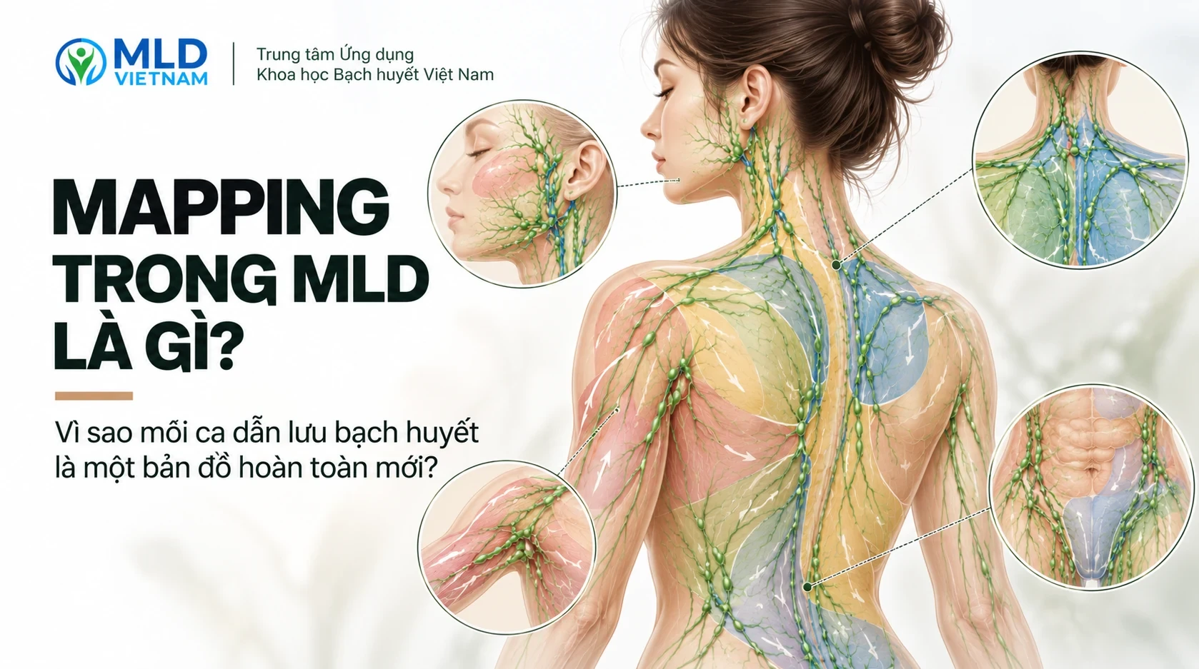 Mapping trong MLD là gì? Vì sao mỗi ca dẫn lưu bạch huyết là một bản đồ hoàn toàn mới